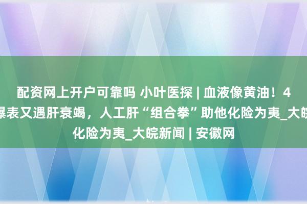 配资网上开户可靠吗 小叶医探 | 血液像黄油！41岁男子血脂爆表又遇肝衰竭，人工肝“组合拳”助他化险为夷_大皖新闻 | 安徽网